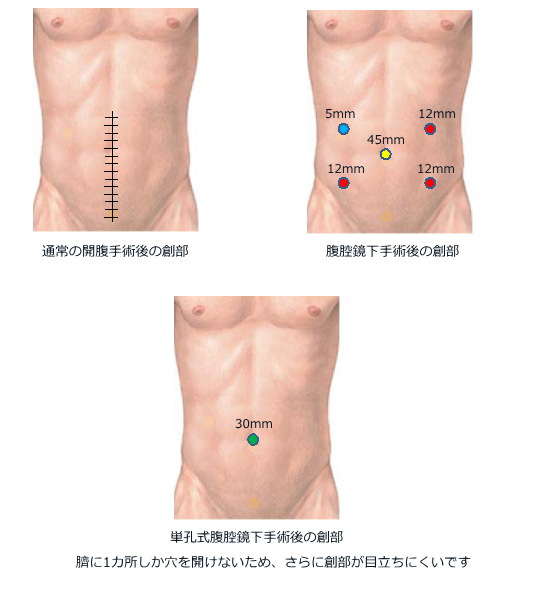 消化器外科 公益財団法人 佐々木研究所附属 杏雲堂病院