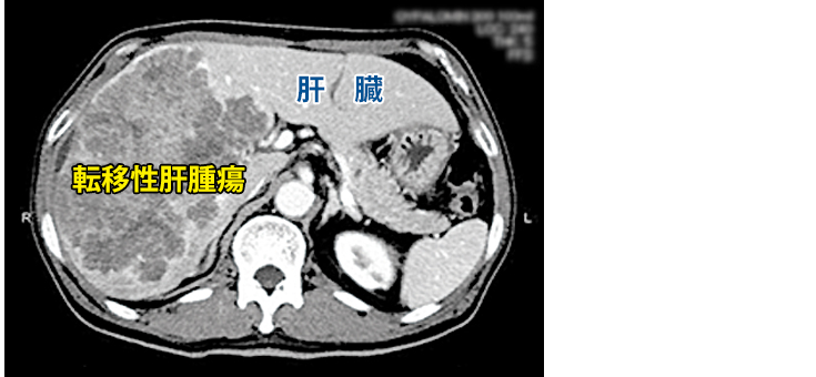 集学的治療-1