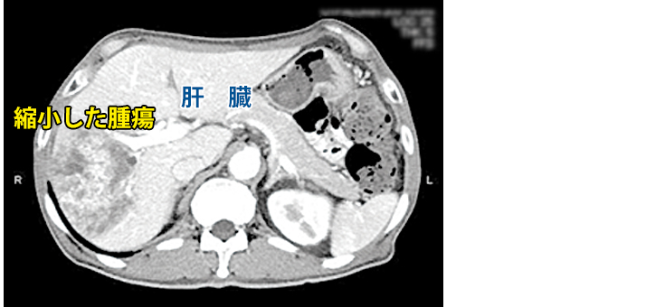 集学的治療-2