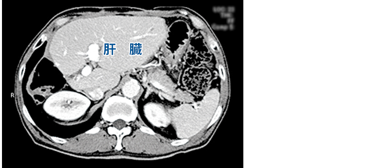 集学的治療-3